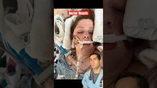 Doctor Reacts Inhaling Bleach?