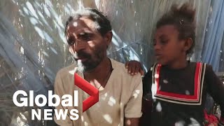 “We have lost everything”: War in Ethiopia's Tigray wrenches families apart