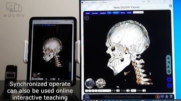 Start Medical Image-based Teleconsultation using Web DICOM Viewer on iPad via Web Push Notification