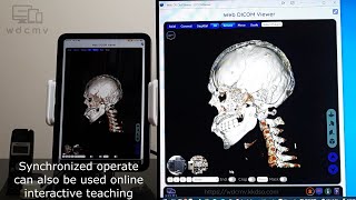 Start Medical Image-based Teleconsultation using Web DICOM Viewer on iPad via Web Push Notification screenshot 2