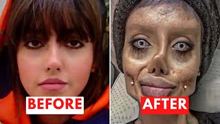 WORST CELEBRITY Plastic Surgery Disaster Ever...