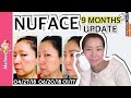 Nuface trinity 9 months results before and after pictures update review