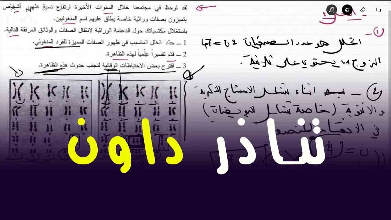 علوم طبيعية الرابعة متوسط تمرين على تناذر داون و الطوابع النووية
