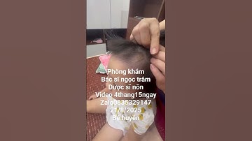 rụng tóc mảng. bé huyền. video 4 tháng 15 ngày #toctoc