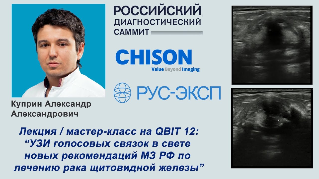 Мастер-класс (лекция) УЗИ голосовых связок (CHISON QBIT 12)
