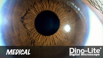 Dino-Lite Applications: Medical