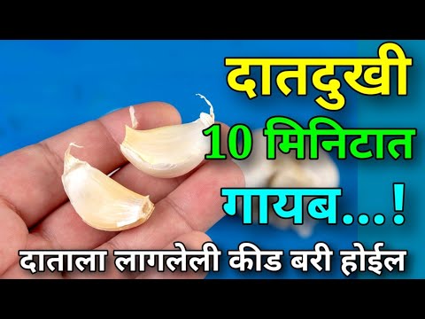 10 मिनिटात दात दुखी गायब ! Tooth pain ! Dat dukhi var upay