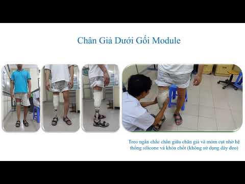 Chân giả dưới gối Silicone + Khóa chốt (Cách tháo lắp chân giả hệ thống treo Silicone và Khóa chốt)