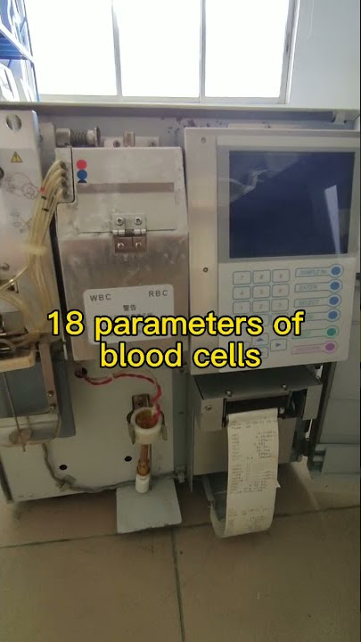 【Sysmex kx21 Hematology Analyzer】