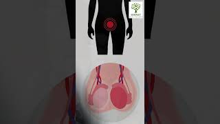 Azoospermia Type Check Guide | Comment “REPORT” to Know Your Exact Cause