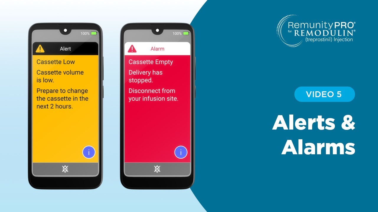 RemunityPRO User Guide Video 5: Alerts & Alarms - YouTube