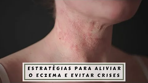 Como curar eczema ao redor dos olhos?