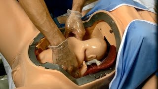 Gaumard® Victoria® S2200 : Vaginal Breech Delivery How-To Ep 8/18