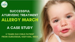 Successful Ayurvedic Treatment of Allergy March - A Case Study