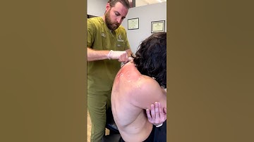 Would You Try Muscle Scraping? Hurts So Good!