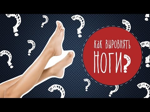 Как выровнять ноги? Силиконовая накладка против «косточки» на стопе