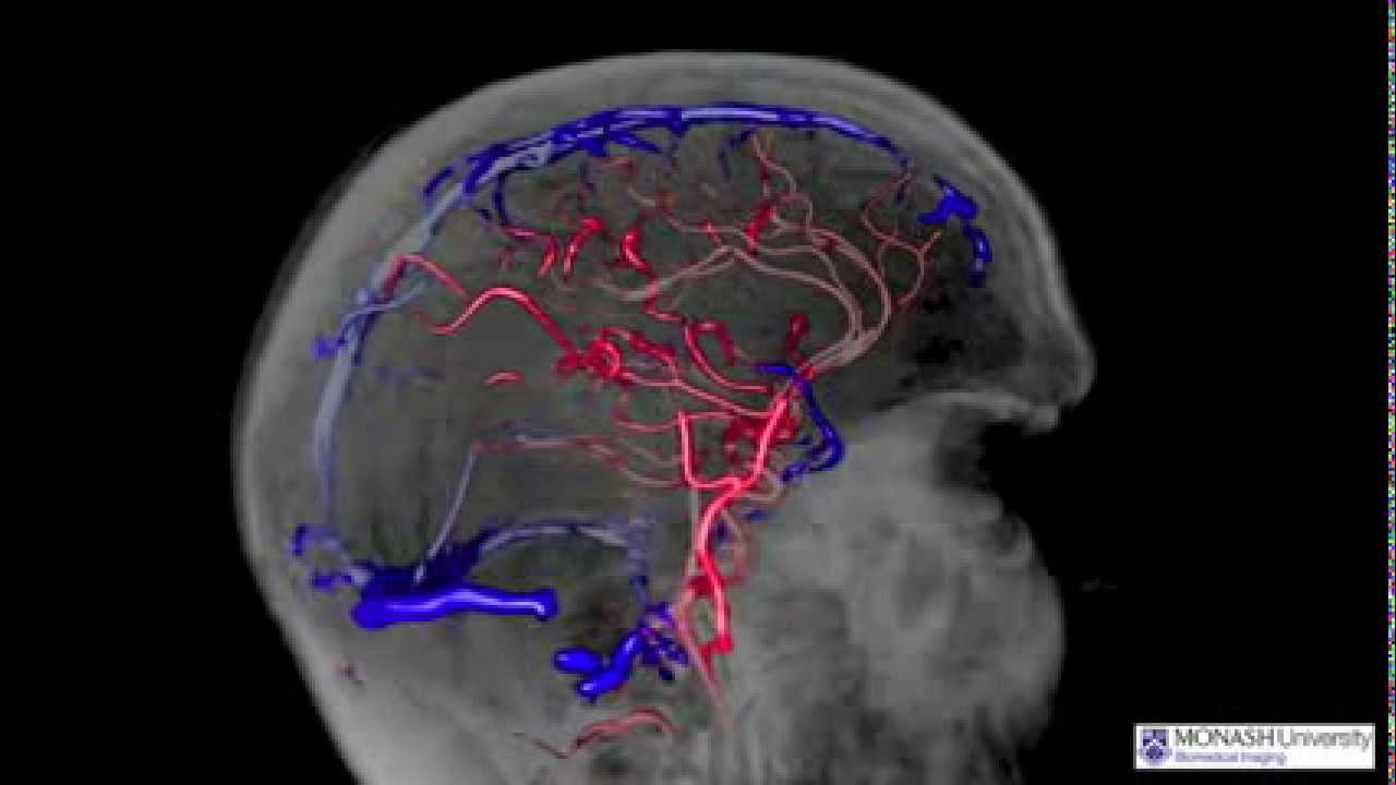 Cerebral arterial and venous networks YouTube