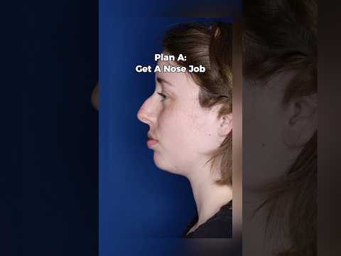 Video thumbnail: 28-Year-Old Rhinoplasty Before & After | 2 Months Post-Op · Kalos Facial Plastic Surgery