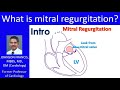 What is mitral regurgitation? - Intro