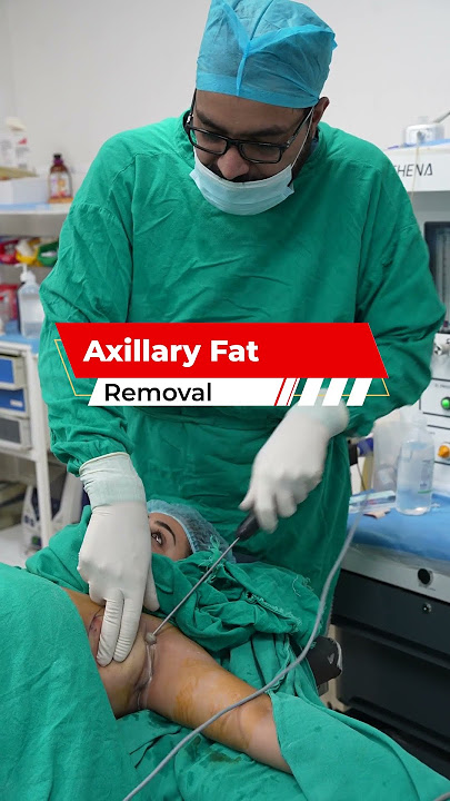 Axillary Fat Removal | Axillary Fat | Axillary Fat cost | Dezire Clinic #shortvideo #shorts