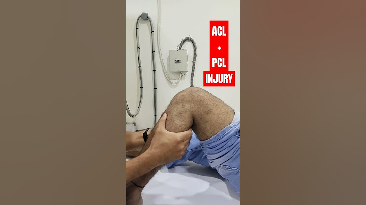 ACL PCL ligament injury in Knee joint | Drawer Test | #aclreconstruction #ligamentinjury #knee