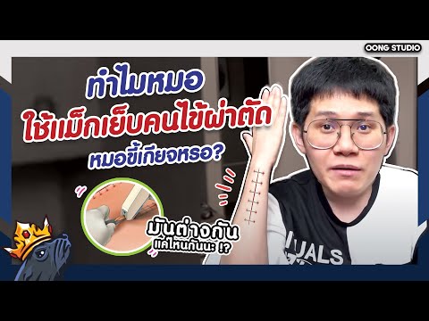 หมอเอาไส้แมวมาเย็บแผลหรอ!!!แล้วใช้แม็กเย็บคือหมอขี้เกียจใช่มั้ย?