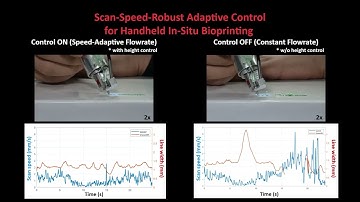 Scan-Speed-Robust Adaptive Control for Handheld In-Situ Bioprinting