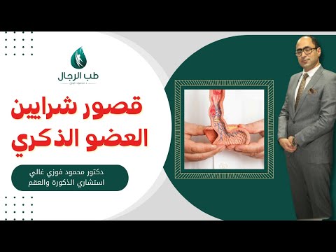 اعراض قصور شرايين العضو الذكري دكتور محمود فوزي غالي