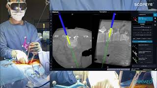 SCOPEYE video used in Stealth surgery_Lawmed