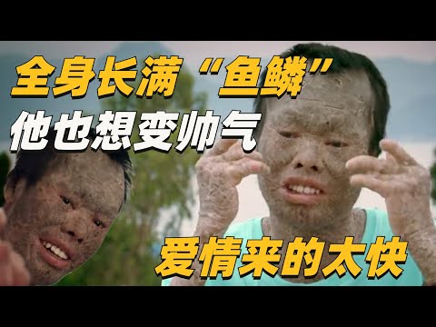 出生就患有罕见皮肤病，全身皮肤厚如城墙。却从来没看过病，这次寻医之旅，找到了爱情？