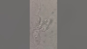 Urine sediments under the microscope #laboratory #microscope #mls #cls #medtechstudent #urine #rmt