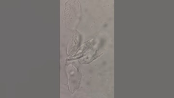 Urine sediments under the microscope #laboratory #microscope #mls #cls #medtechstudent #urine #rmt