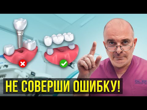Лучшая альтернатива ЗУБНЫМ ИМПЛАНТАМ! Что выбрать вместо имплантации?