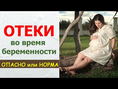 Отеки во время беременности. Опасность или норма