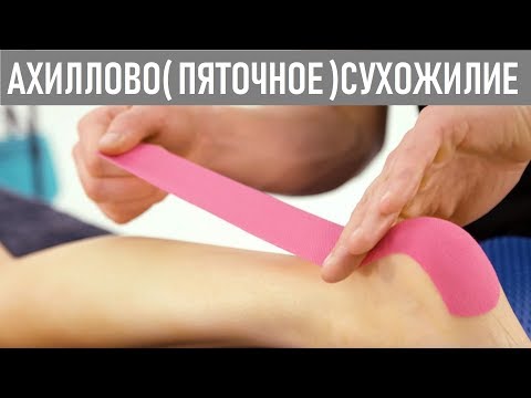 Тейпирование ахиллова сухожилия | Taping guide for Achilles Tendonitis
