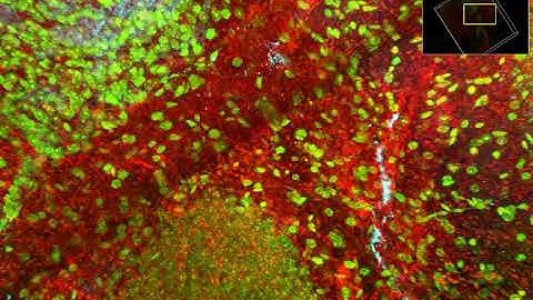 Mouse Brain - Coronal Section ROI