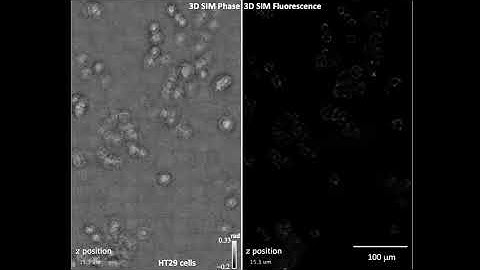 Speckle-structured illumination for 3D phase and fluorescence computational microscopy