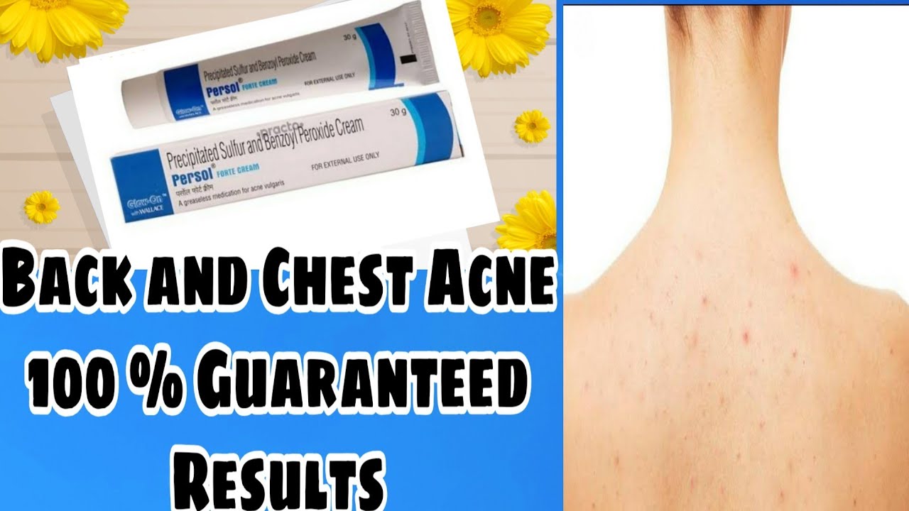Back Acne And Chest Acne 100 relief Persol Forte Cream YouTube