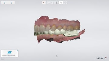 3Shape Implant Studio - Aprovação de caso, Envio pelo Communicate e Salvamento