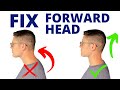 How to Fix Forward Head Posture with 3 Easy Moves