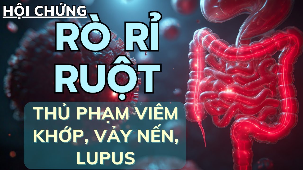 Hội Chứng Rò Rỉ Ruột (Leaky Gut): Tin Đồn Hay Sự Thật Y Học Bị Bỏ Qua?