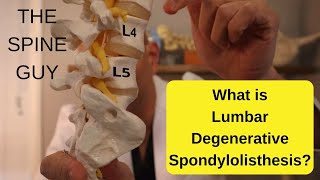 What is Lumbar Degenerative Spondylolisthesis  Part 1