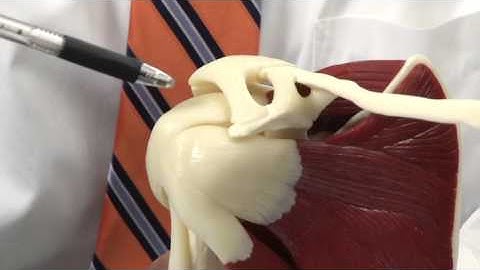 Shoulder Bursitis: Model Demonstration