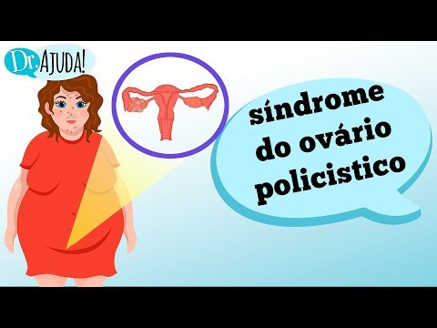 SÍNDROME DO OVÁRIO POLICÍSTICO: sintomas, causas e mais!