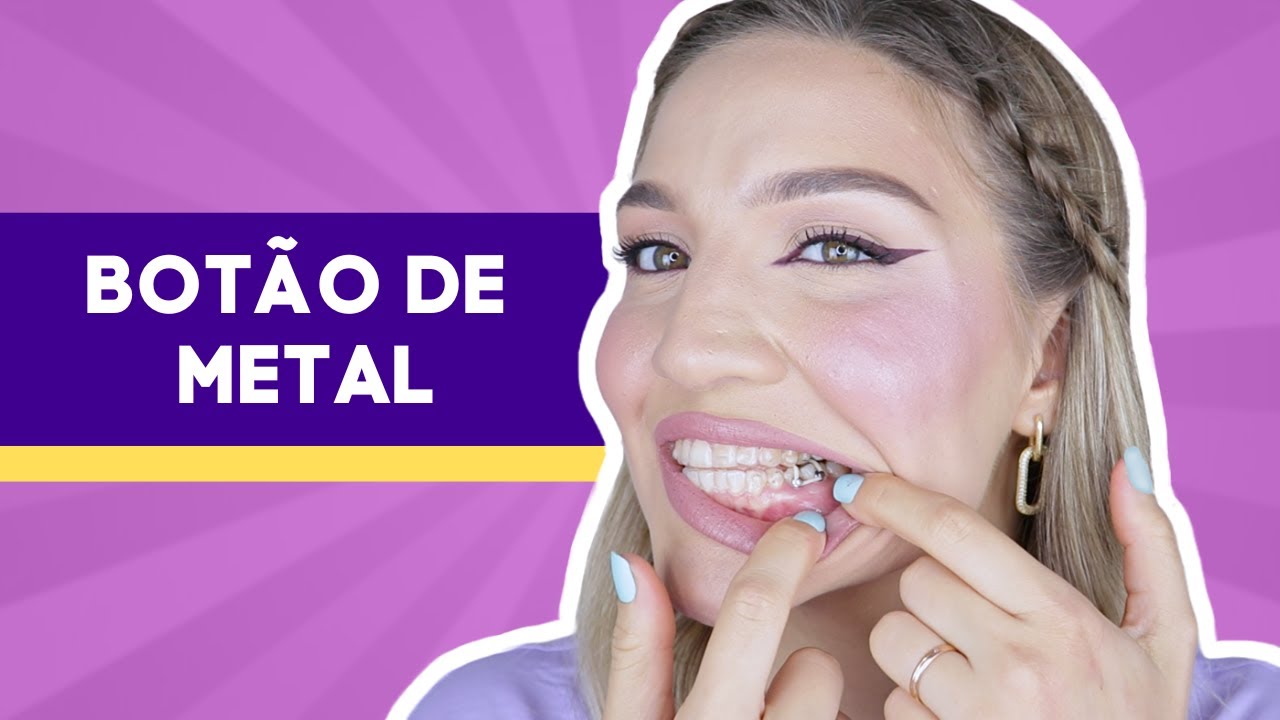 Dois meses usando o INVISALIGN - Minha experiência