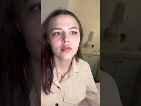 Красивые губы для красивой девушки 😻совместная работа с моей ученицей Полли 🥰 #губыростов