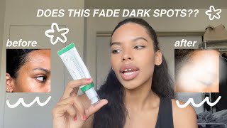 AXISY Dark Spot Correcting Glow Serum Review: Does It Really Work?