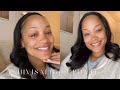 My Invisalign Journey Update: 2 Years With Invisalign | Invisalign Experience 2023