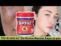 PELE DE Bebê EM 1 DIA REMOVA #MANCHAS #RUGAS NA PELE