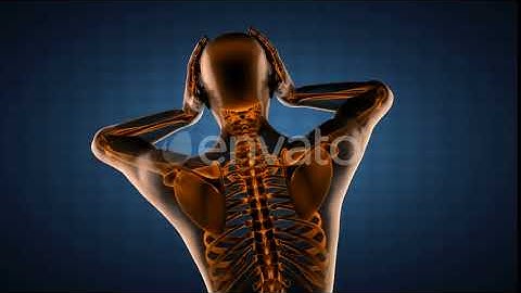 Human Bones Radiographic Scan | Motion Graphics - Videohive template